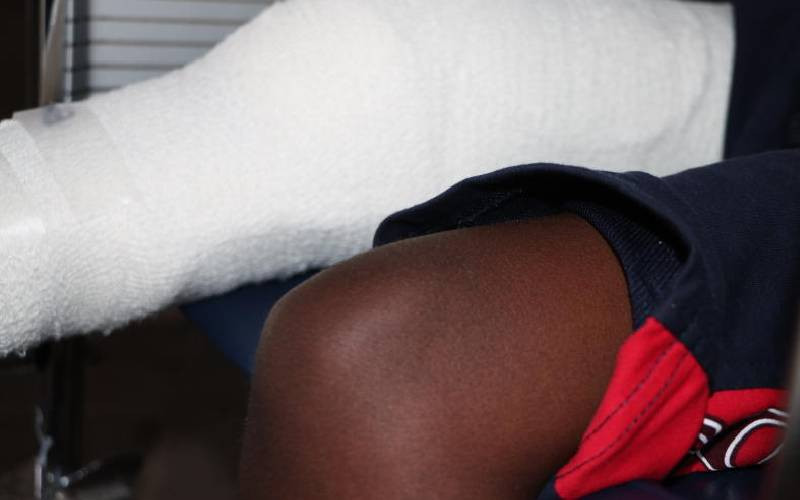 A Kenyan first: Cancerous bone in boy's knee cut out, 'cooked', then placed back