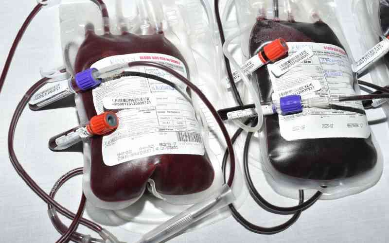 Polycythemia: How too much blood can put you at risk