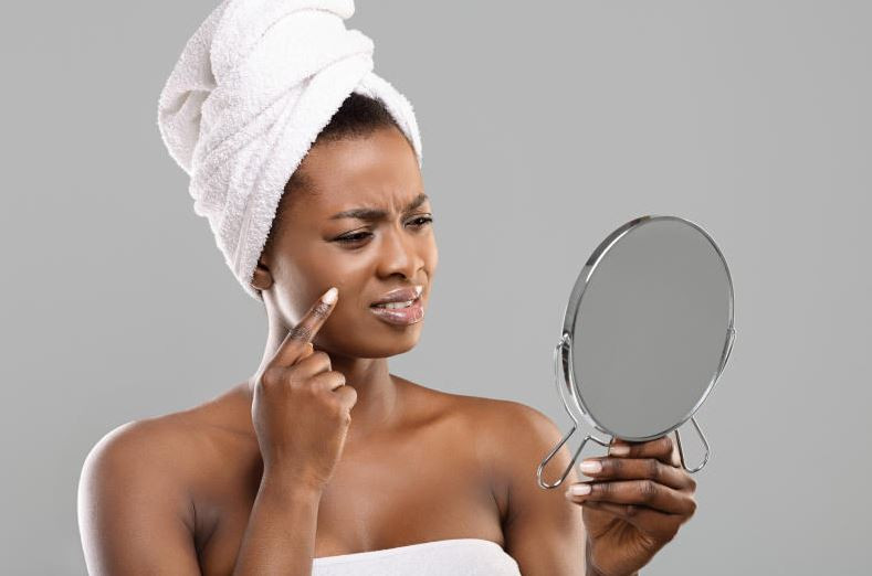 Pimple popping: How to break the tiny habit causing big trouble