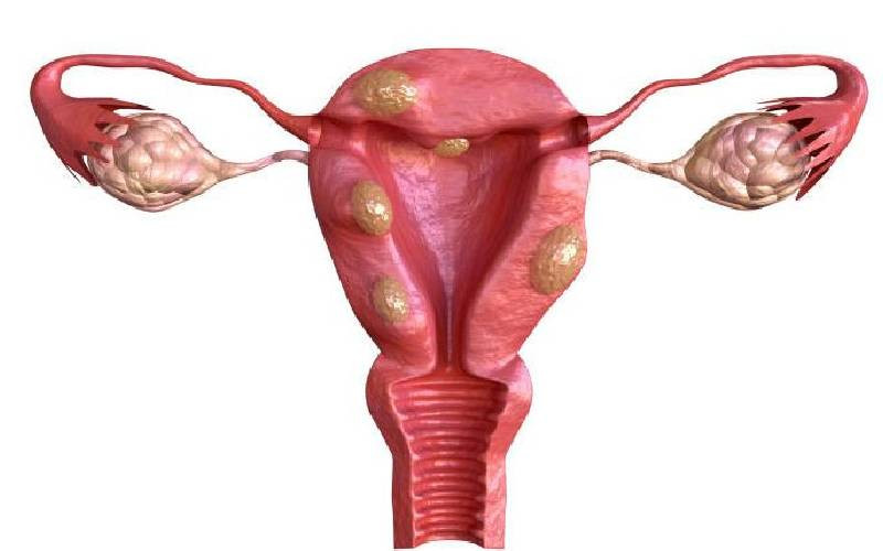 Silent growths within: When large internal masses go unnoticed in women