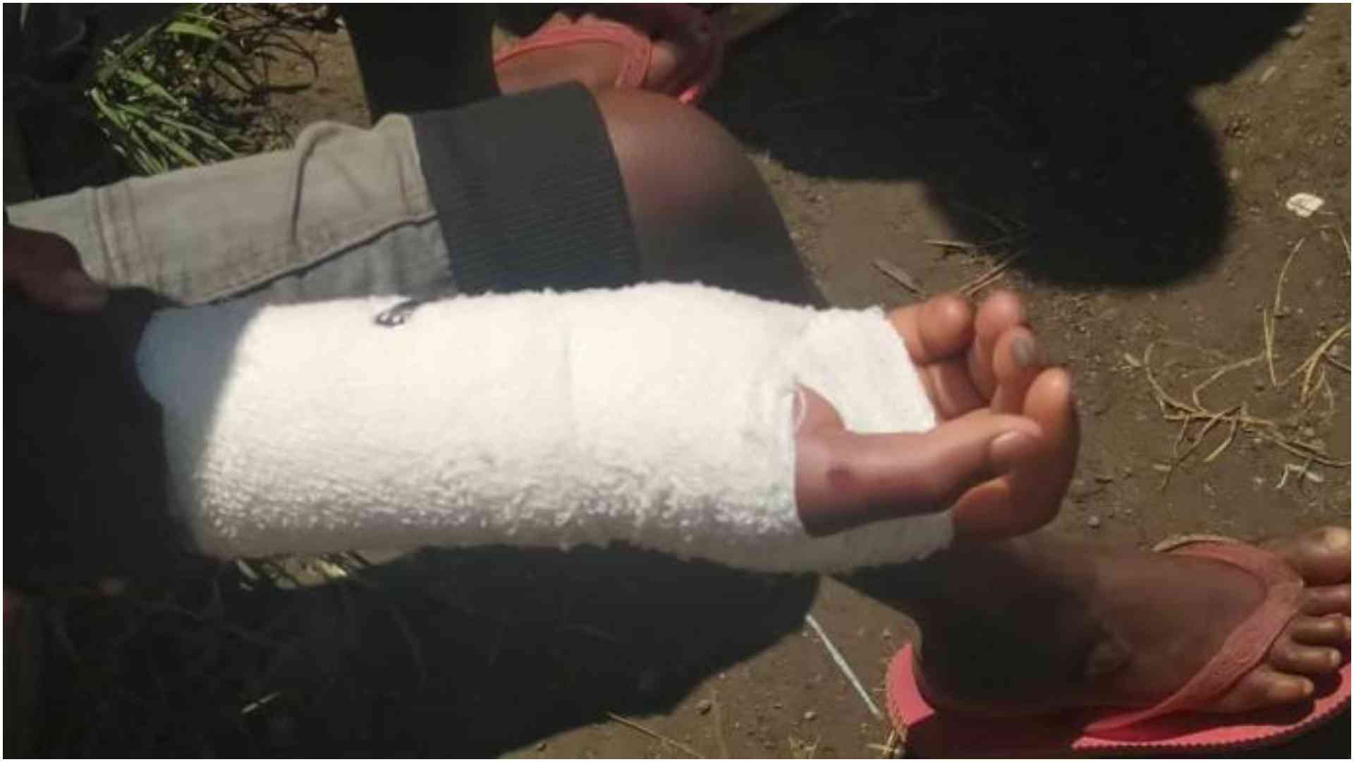 Nairobi woman breaks friend's arm in row over Sh2,000 debt