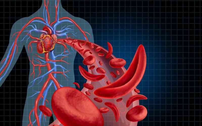 New technology improves survival prospects for sickle cell patients