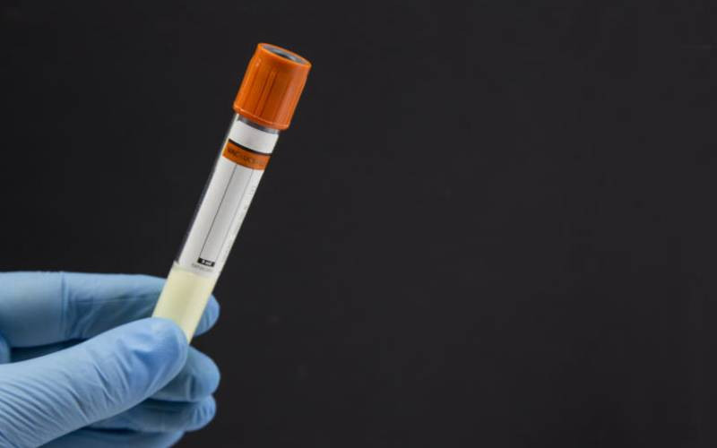 Sperm donation safety: What you must know before choosing a donor