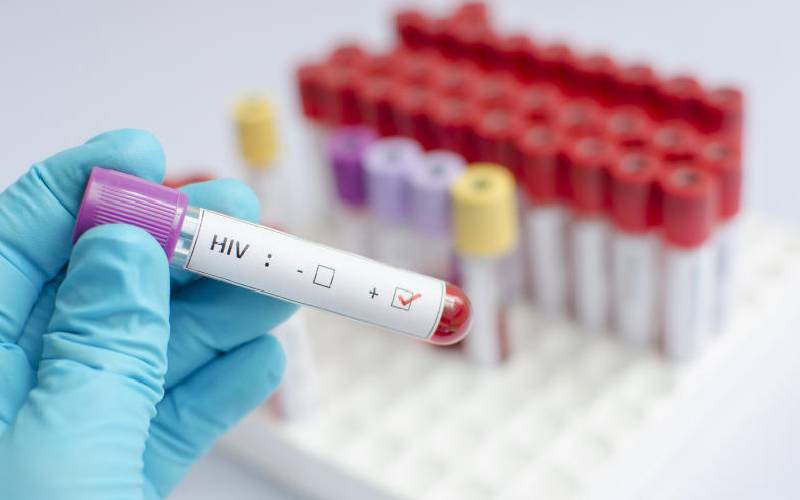 Guarding the gains: Africa moves to tackle rising HIV drug resistance