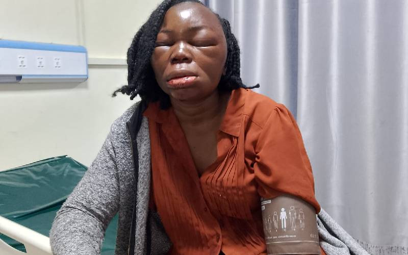 Jilted lover attacks woman in Bungoma