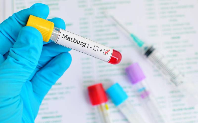 Bloody virus: Why Kenya cannot afford to take chances on Marburg