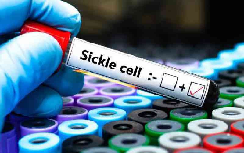 JOOTRH to launch red blood cell exchange for sickle cell