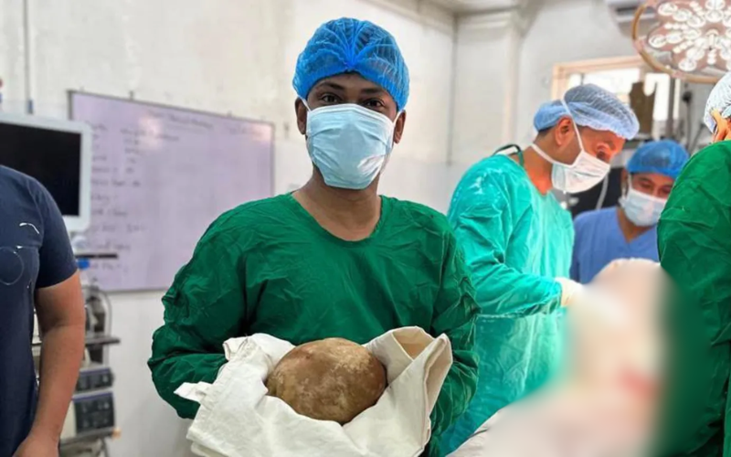 Surgeons remove 'baby-sized' 3.1kg bladder stone from patient