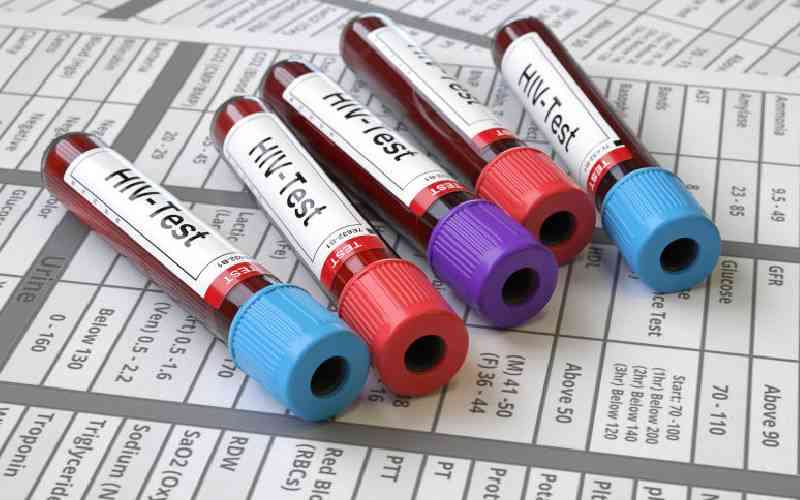 Kisumu participates in study on cause of death among adults with HIV