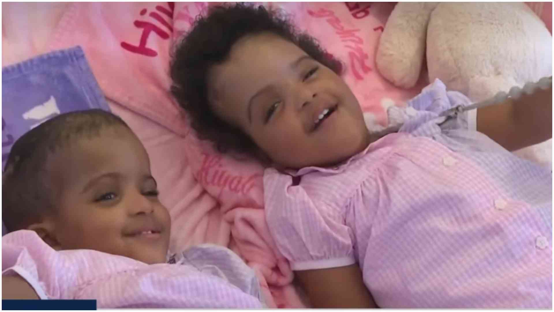 Ethiopian conjoined sisters see each other for first time after successful separation surgery in US