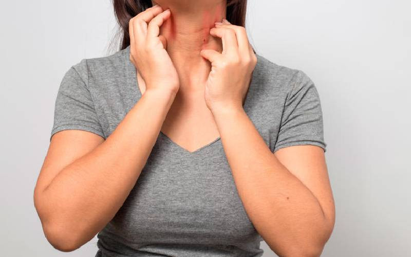 Lupus: Autoimmune disease that attacks more women than men