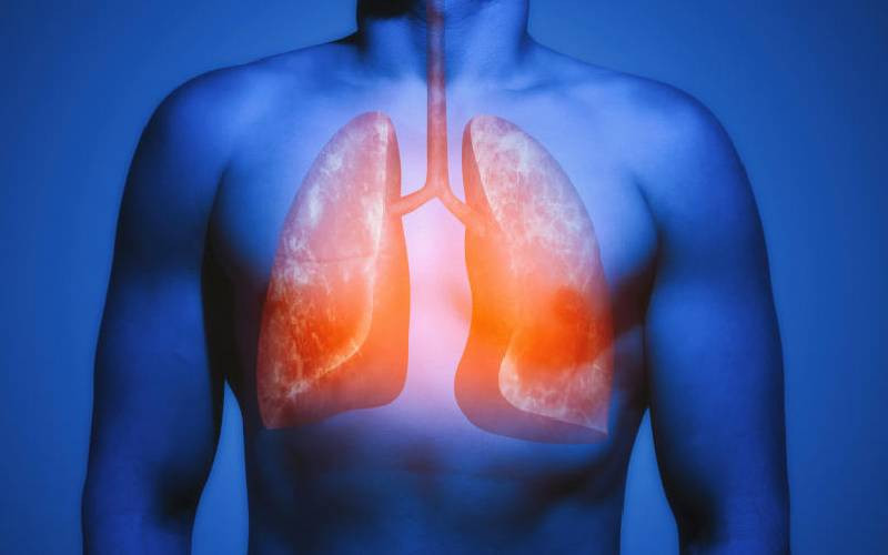 Respiratory infections: Dissecting the world's fourth cause of death