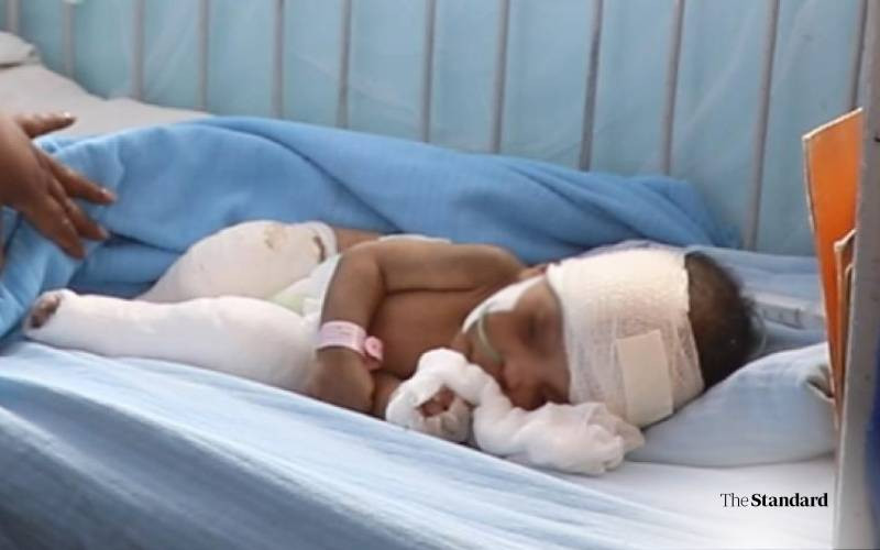 Abandoned but not alone: Babies with disabilites find hope at KNH