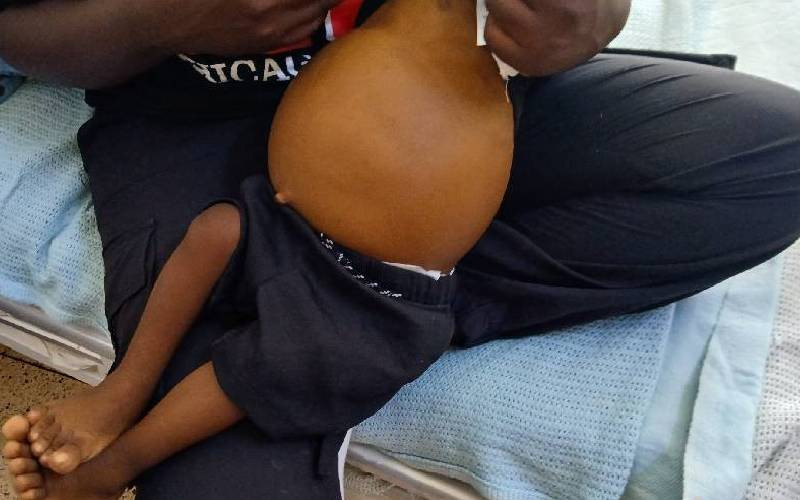 11 Months of pain: Baby Ethan's deadly fight for a new liver that never came
