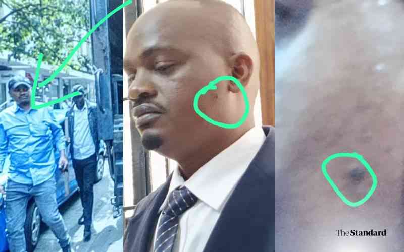 Wasn't me! How officer denied shooting Rex Masai despite evidence