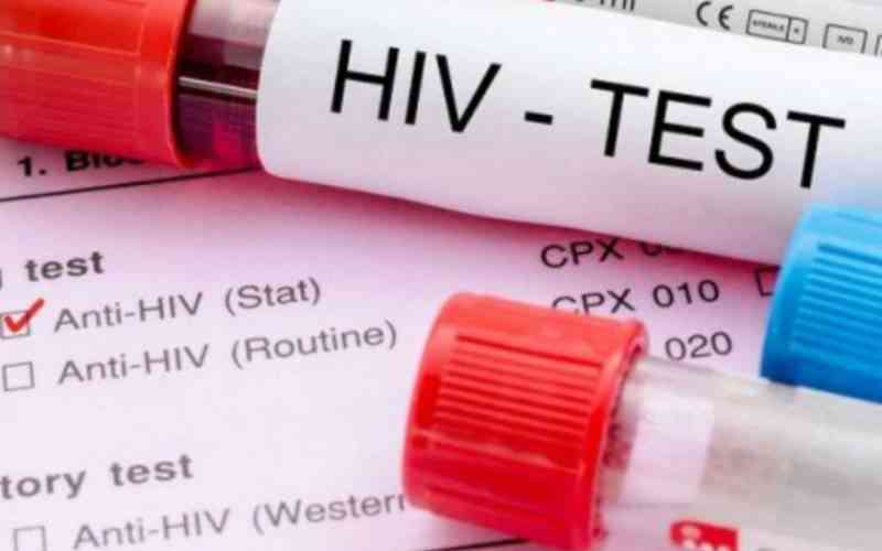 In 2022, at least 61 people contracted HIV daily - report