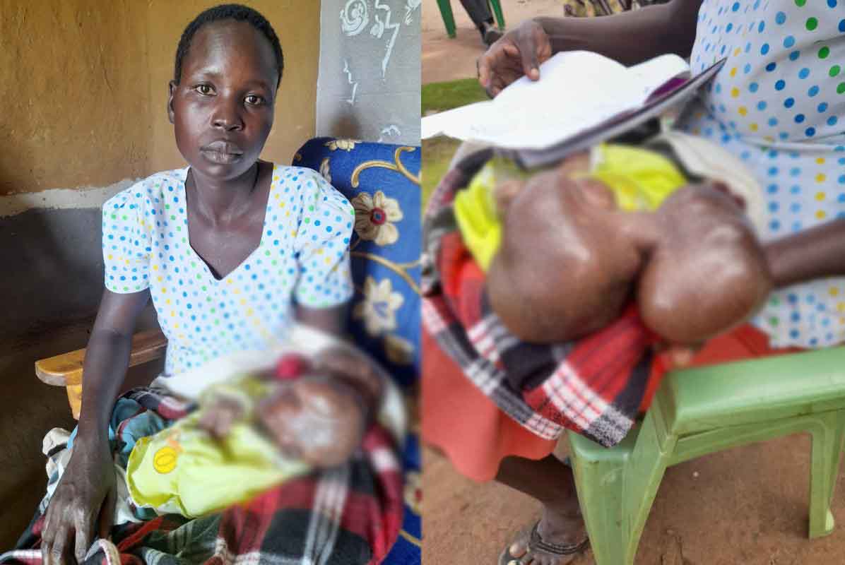 Woman's agony to save baby born with swellings