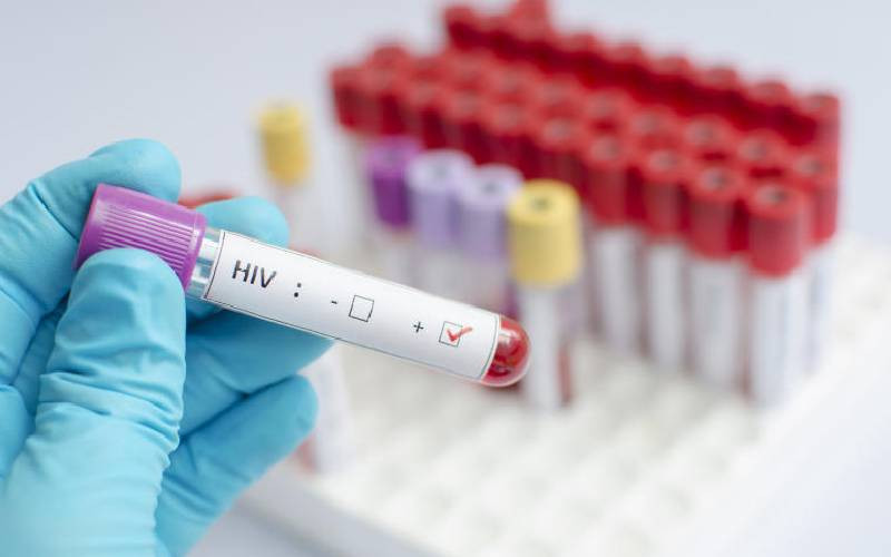 Doctors warn State against plan to acquire 'inferior' HIV test kits