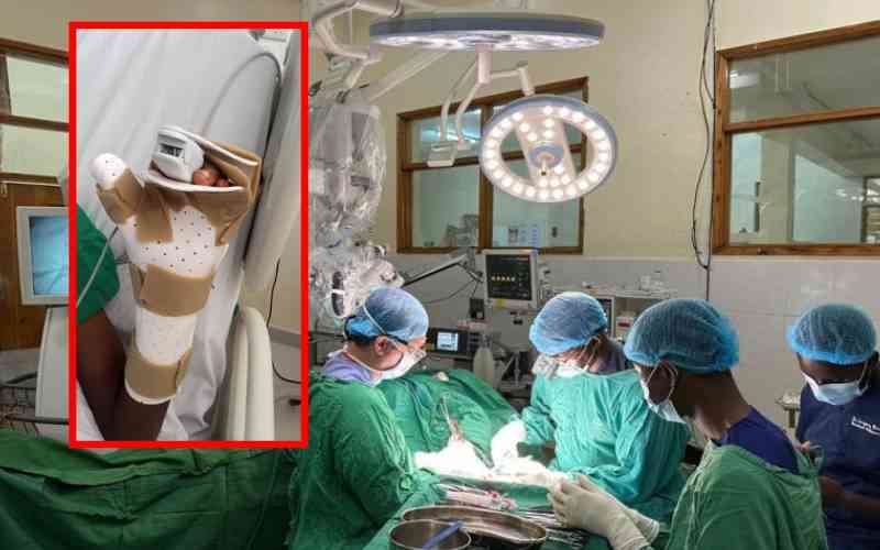 MTRH re-implants a man's limb after an 11-hour surgery