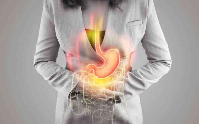 Burb! How to avoid acid reflux