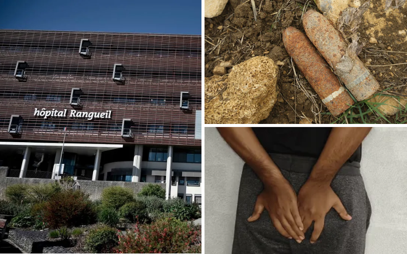 Shock after doctors discover World War I bomb stuck in patient's butt