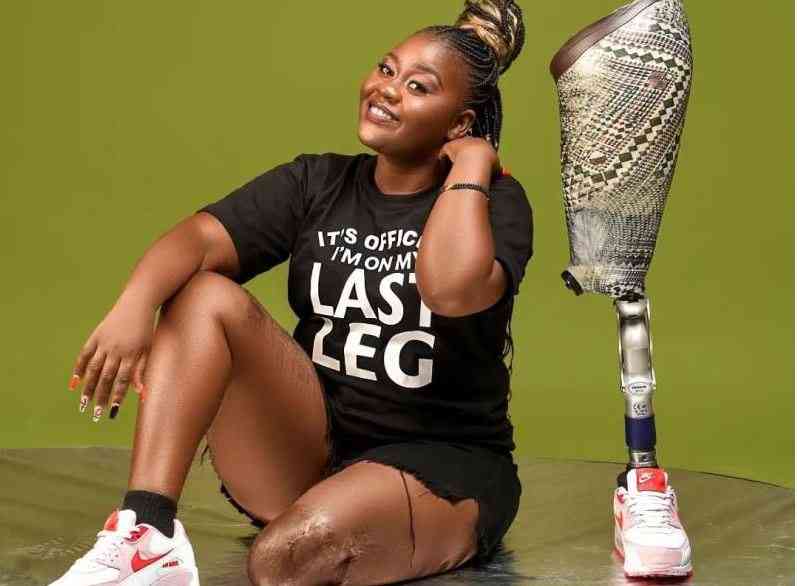 More than a limb lost: How amputees rose above obstacles on their path to independence
