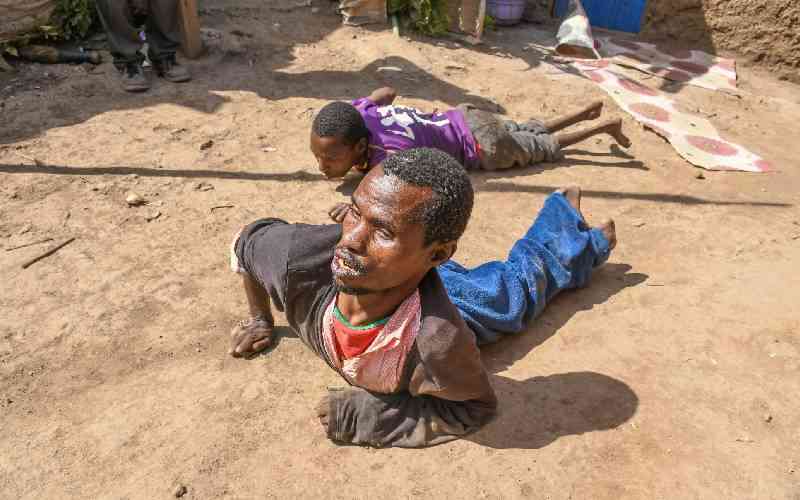 Crawling to live: Family fights rare muscle-wasting disease amid poverty