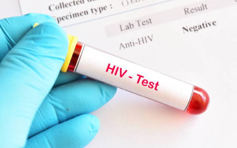 How to transition our HIV response funding