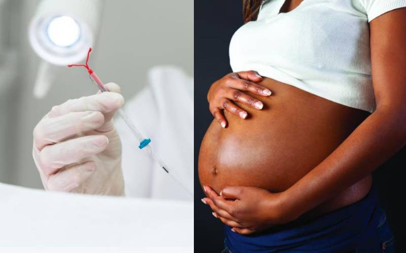 When family planning fails: Bungoma woman's IUD pregnancy sparks call for awareness