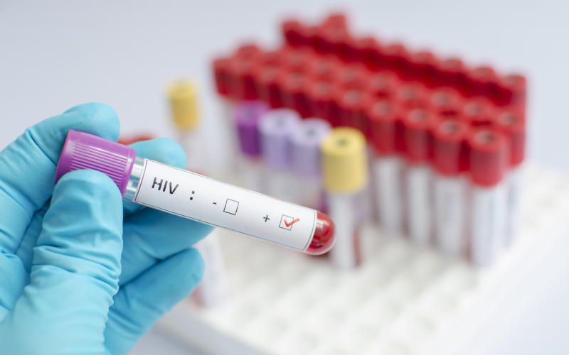 How Pepfar funding cut will hurt Africa