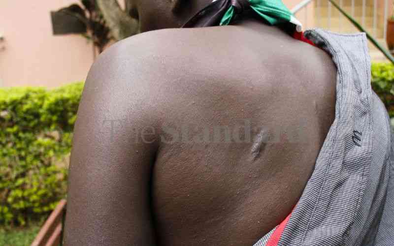 Tortured but unbroken: Abductees recall ordeal