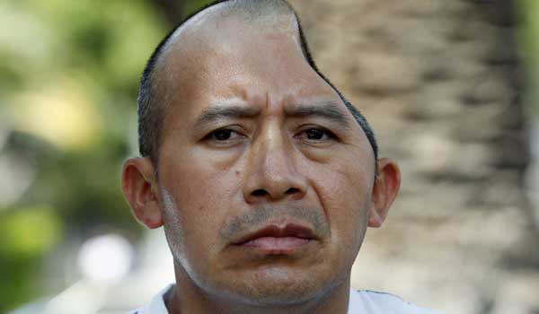 Man awarded Sh4.9 billion for skull damage suffered in California