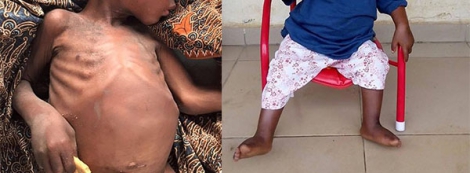 Nigerian 'witch' toddler makes amazing recovery after being found starving