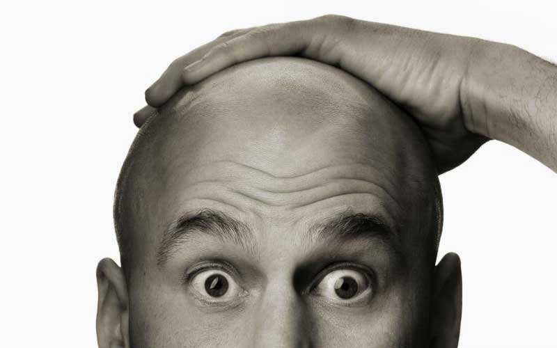 Ask a doctor: Is there a treatment that reverses balding?
