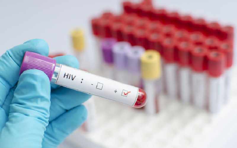 Hospitals hit by shortage of HIV testing kits