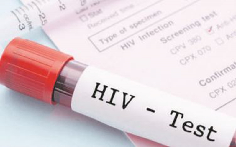 Central region losses 8 people daily to Aids