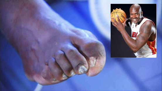 James harden toes online