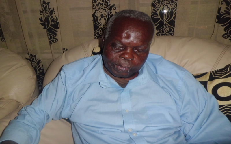 Oduya Oprong-Ex-MP who died with bullet in head after 26 years