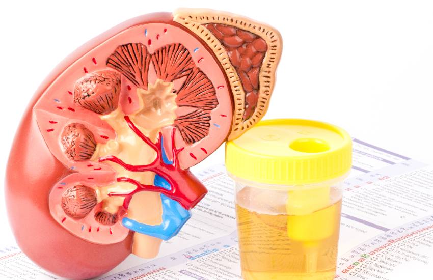 Urine will be vital in kidney transplant