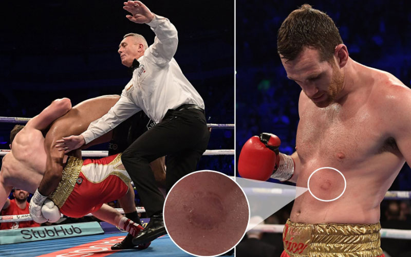 Kash Ali disqualified for biting David Price in bizarre heavyweight bout, Boxing