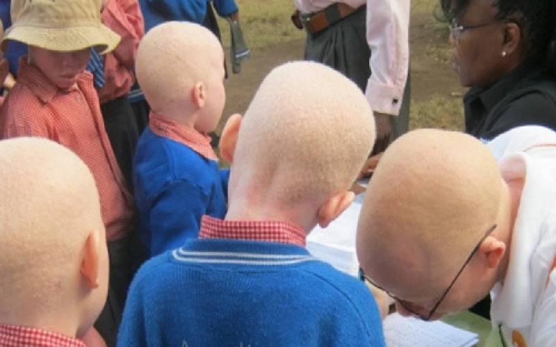 Malawi sentences man to death for murder of albino