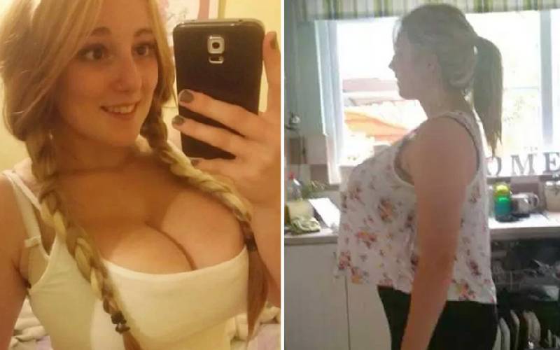 Gigantic boobs girl refused breast reduction on the NHS