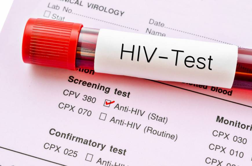 Device for testing HIV in newborns unveiled