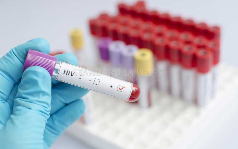 Holistic approach key to medicare for victims of HIV