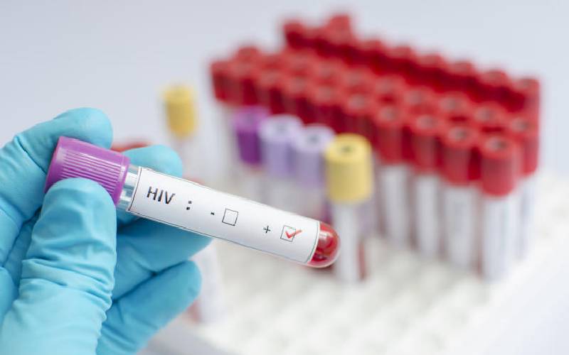 Uptake of HIV self-test kits high in men, youth 