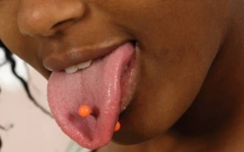 Tongue piercings can fill brain with pus, cause Herpes photo