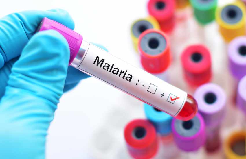 Malaria patients to test for Covid-19 in new directive