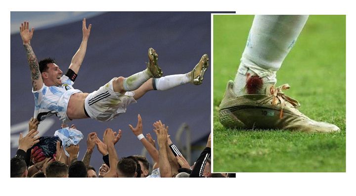 Messi played Copa America final with injury, says coach