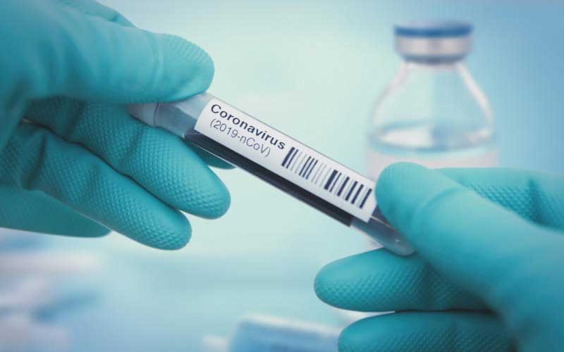 Testing kits shortage hampers coronavirus mass-testing