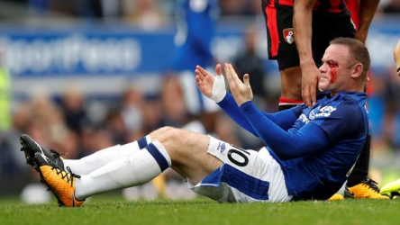 Wayne Rooney suffers nasty eye injury with blood pouring from his face